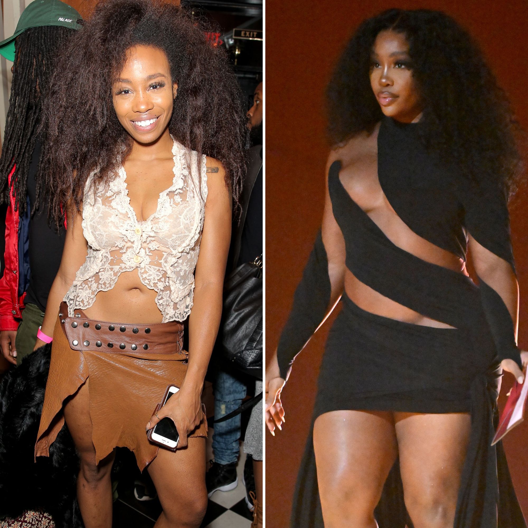 SZA before surgery: a look back at her early days and pre-surgery appearance.
