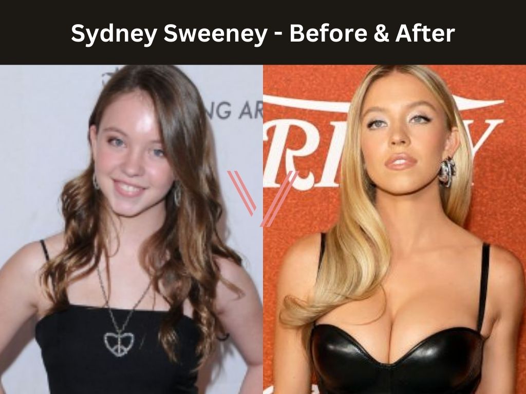 Sydney Sweeney Breasts Before and After: Has She Had Surgery?