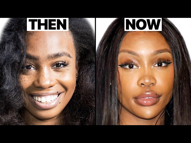 SZA before surgery: a look back at her early days and pre-surgery appearance.