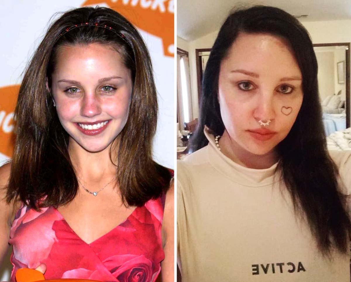amanda bynes now 2024: See How Shes Changed! (Then and Now Photos of the Former Child Star)