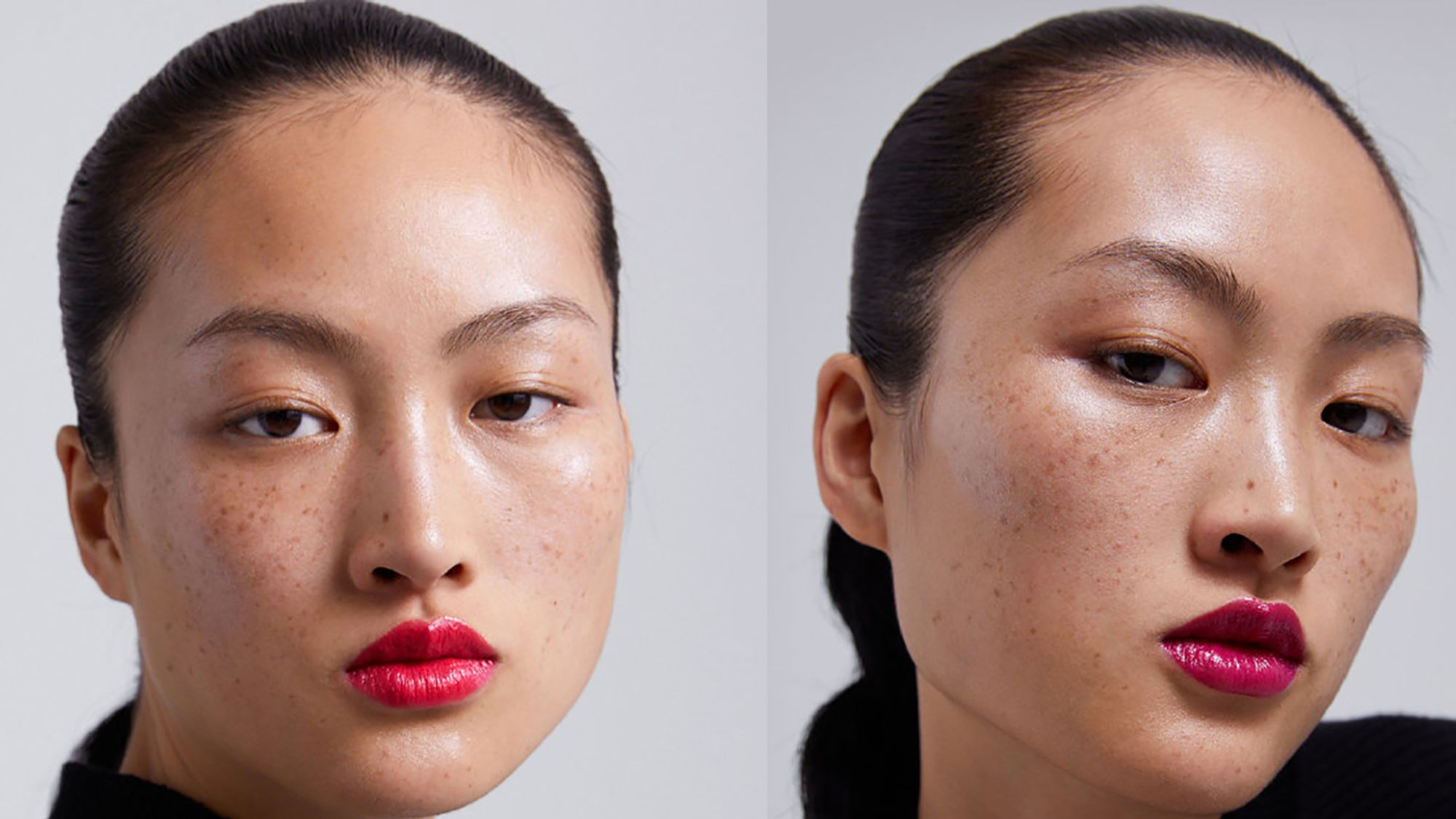 How to love your Asian freckles? Get answers from these beauty tips.