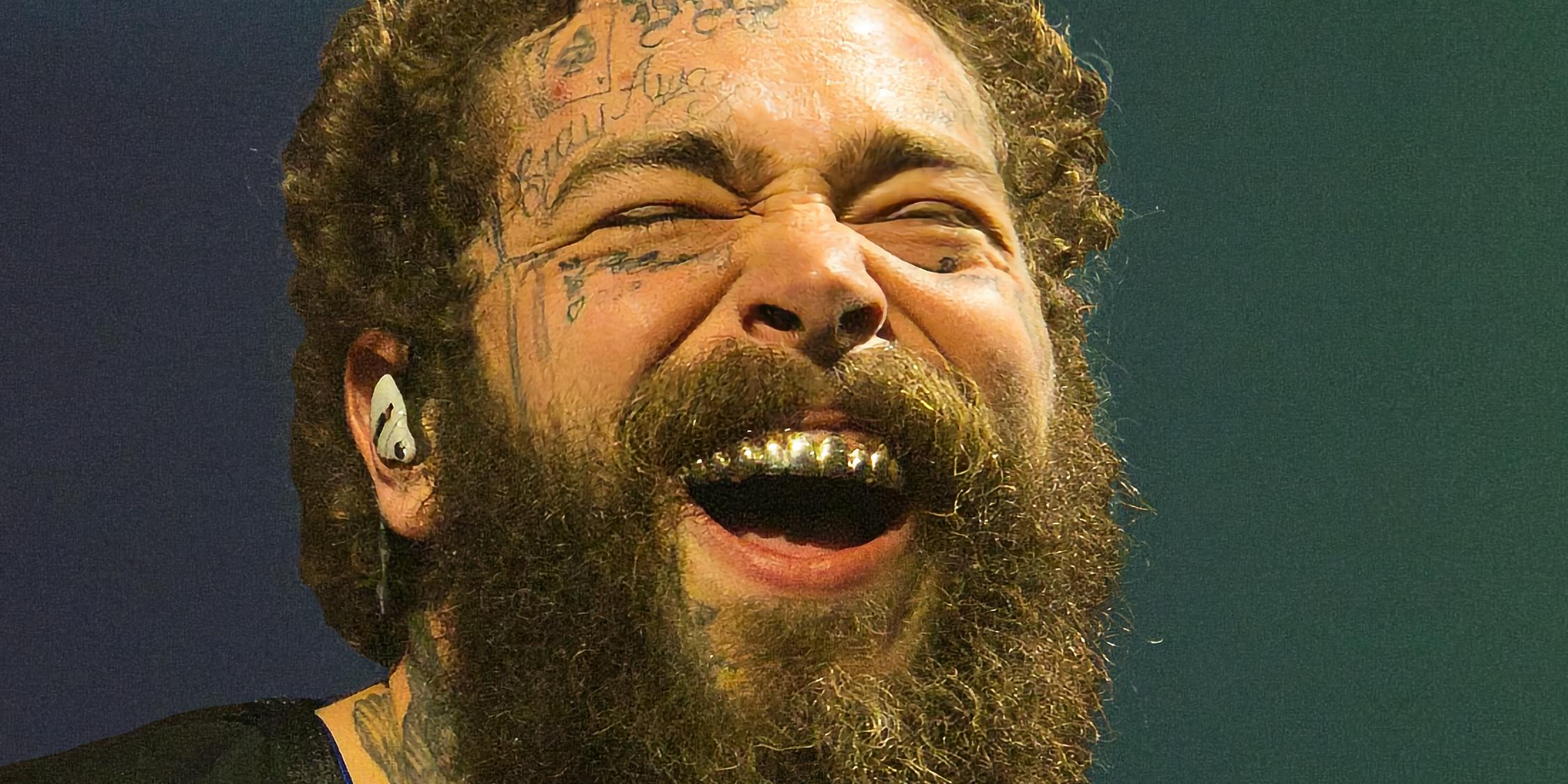 What happen with post malone teeth mount? All you need to know about his new look