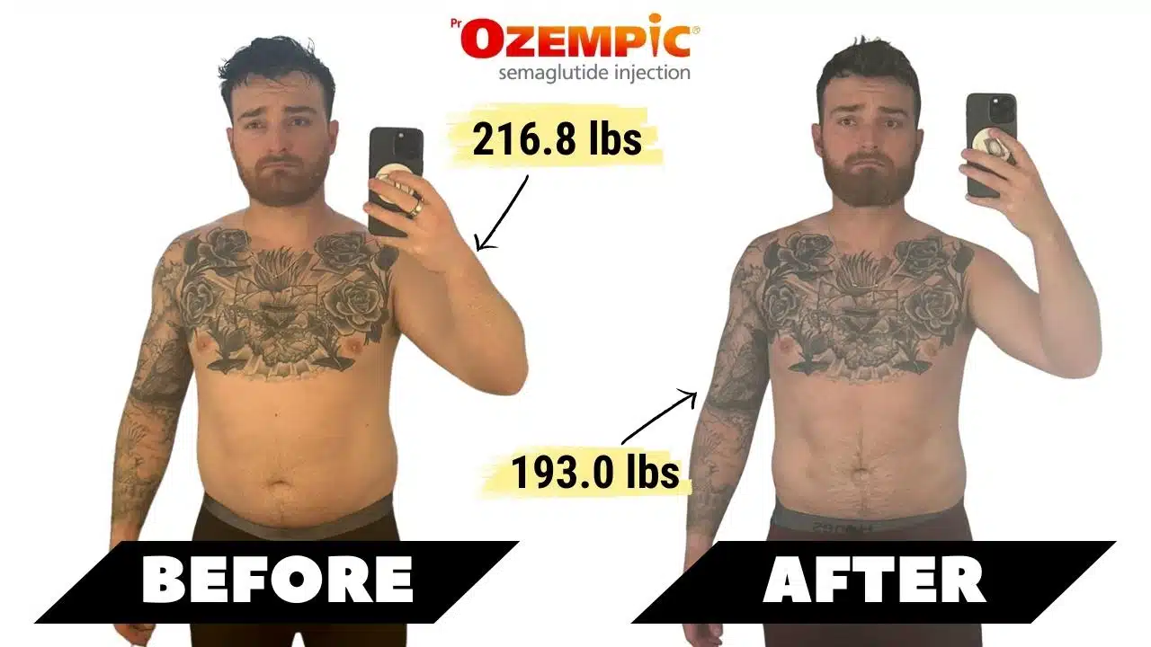 Thinking About Ozempic? See These Before and After Results First!