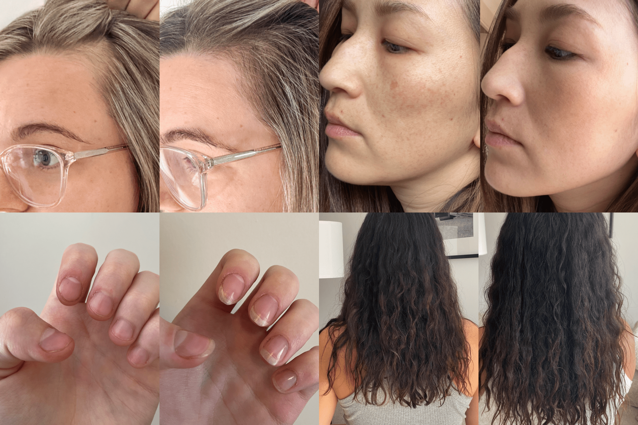 Collagen Supplements Before and After: What to Expect