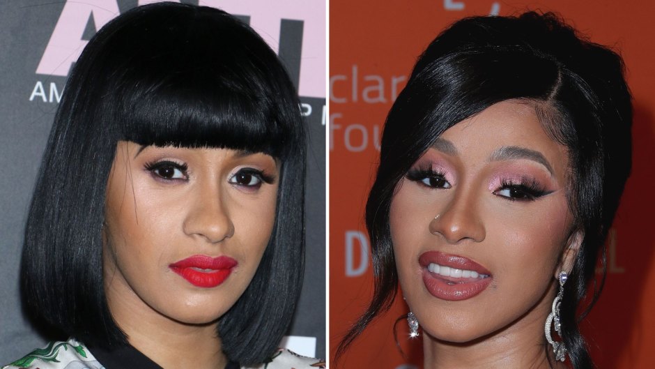 Cardi B Before and After Photos: The Truth Behind Her Change, Get the Details!
