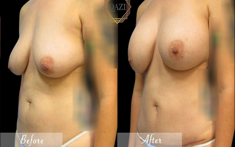 Meet The Biggest Breast Models: Pictures and Profiles Inside