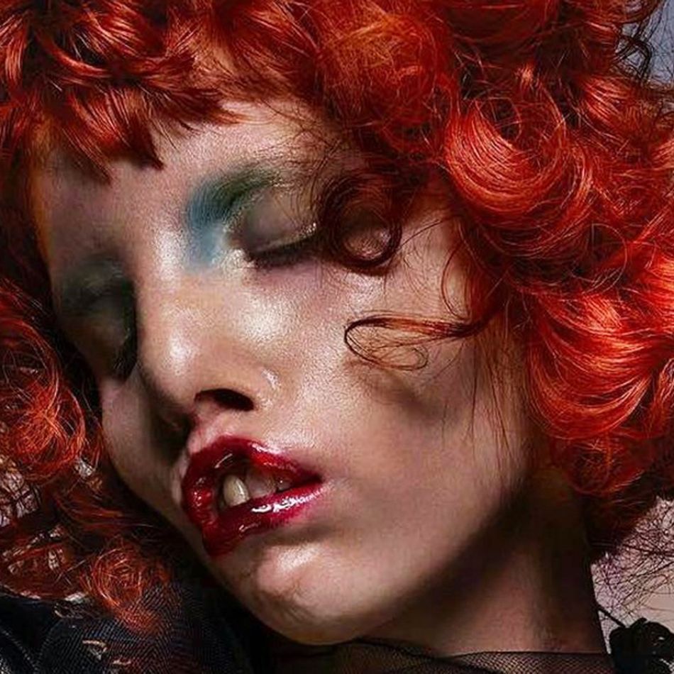 Need inspiration from a model with cat eye syndrome? Discover her amazing journey and impact.
