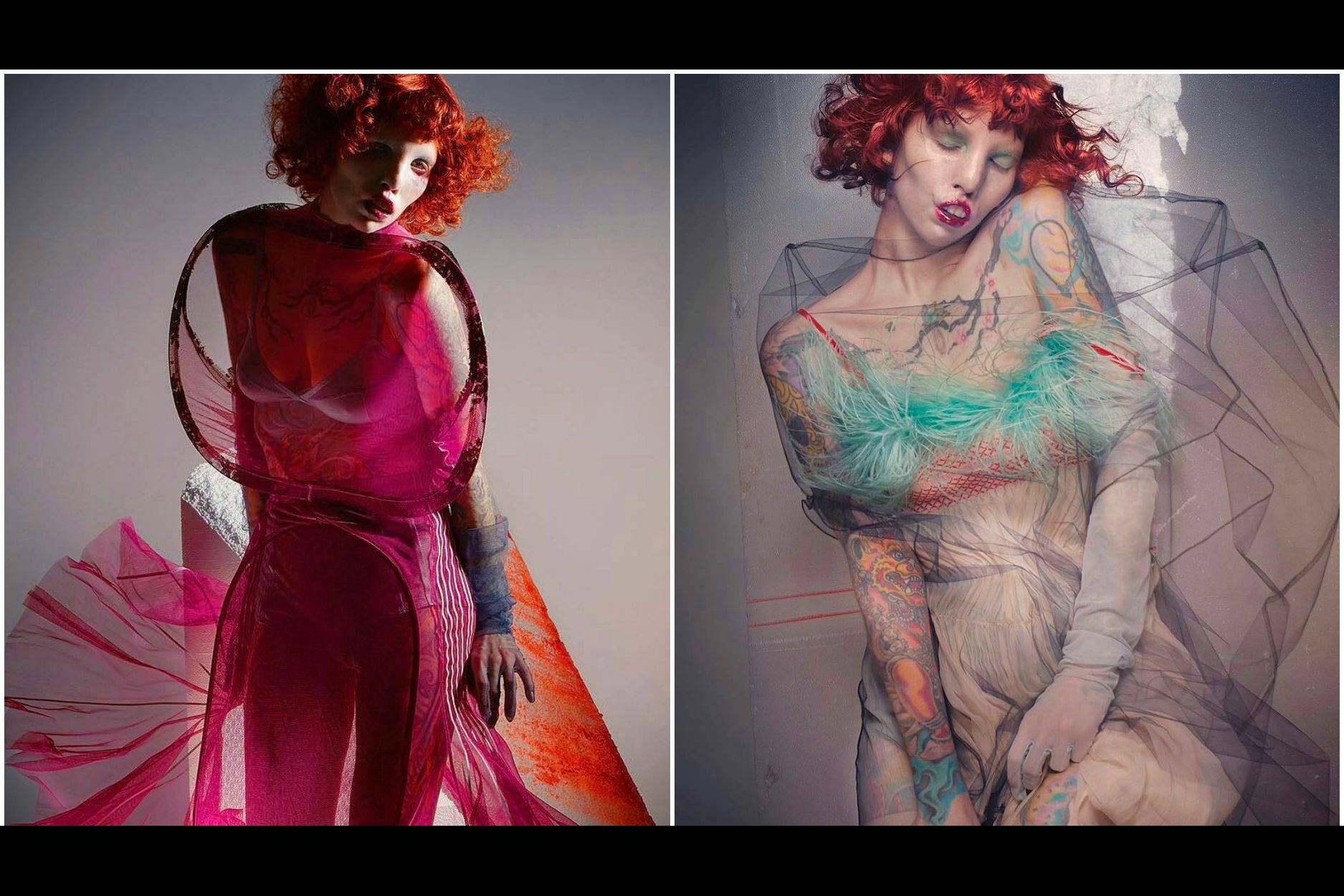 Need inspiration from a model with cat eye syndrome? Discover her amazing journey and impact.