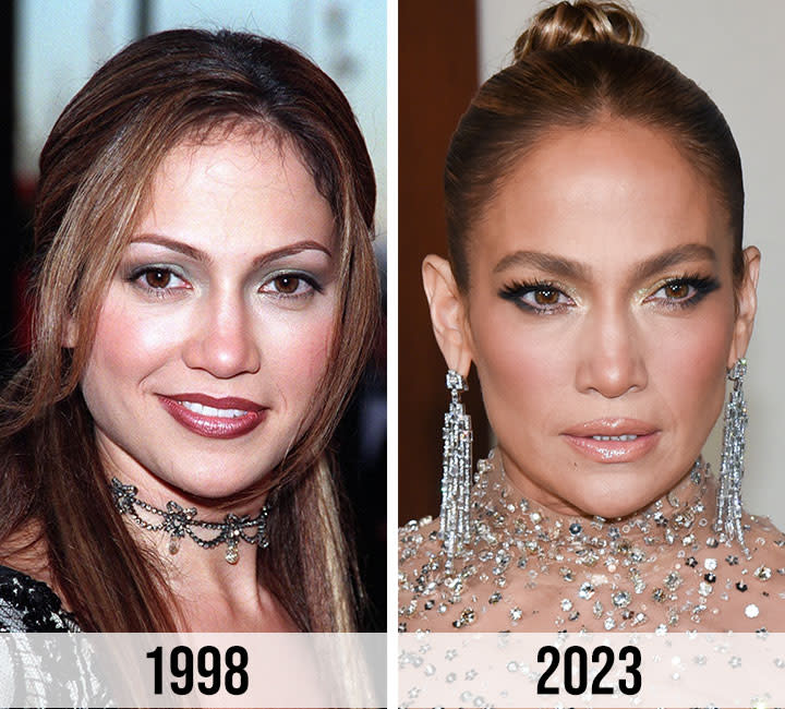 Jennifer Lopez plastic surgery before and after pics: See the comparison photos through the years.