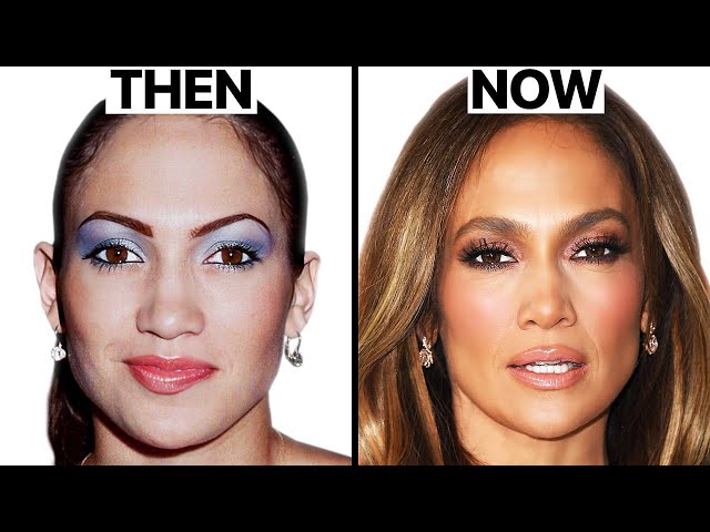 Jennifer Lopez plastic surgery before and after pics: See the comparison photos through the years.