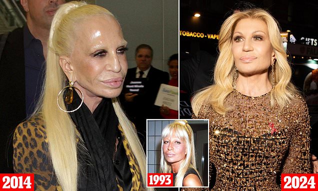 Whats the real story behind Donatella Versace new face? We explore the rumors about Donatella Versace new face.