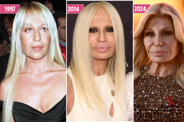 Whats the real story behind Donatella Versace new face? We explore the rumors about Donatella Versace new face.