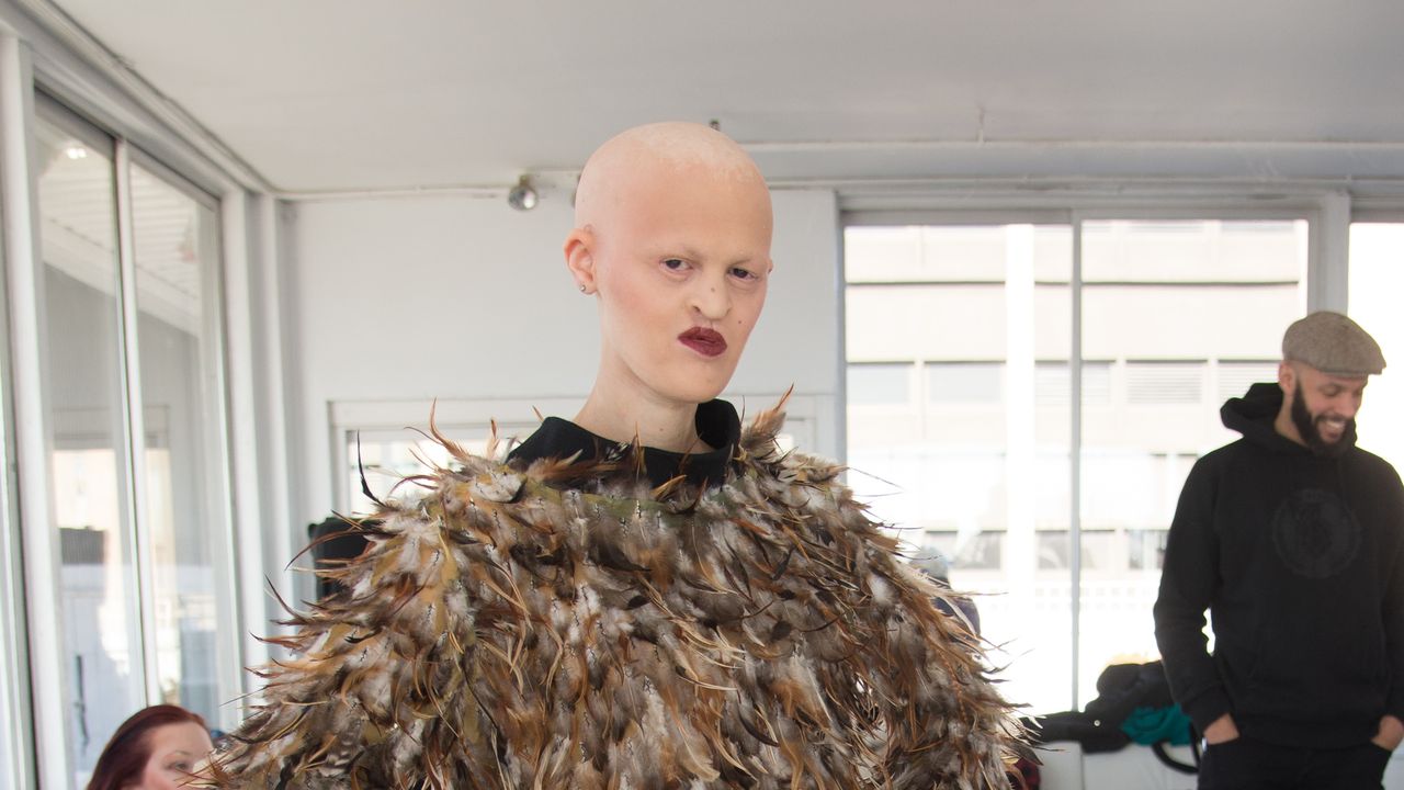 What makes Melanie Gaydos so unique? (Learn about her brave journey in the fashion industry now)