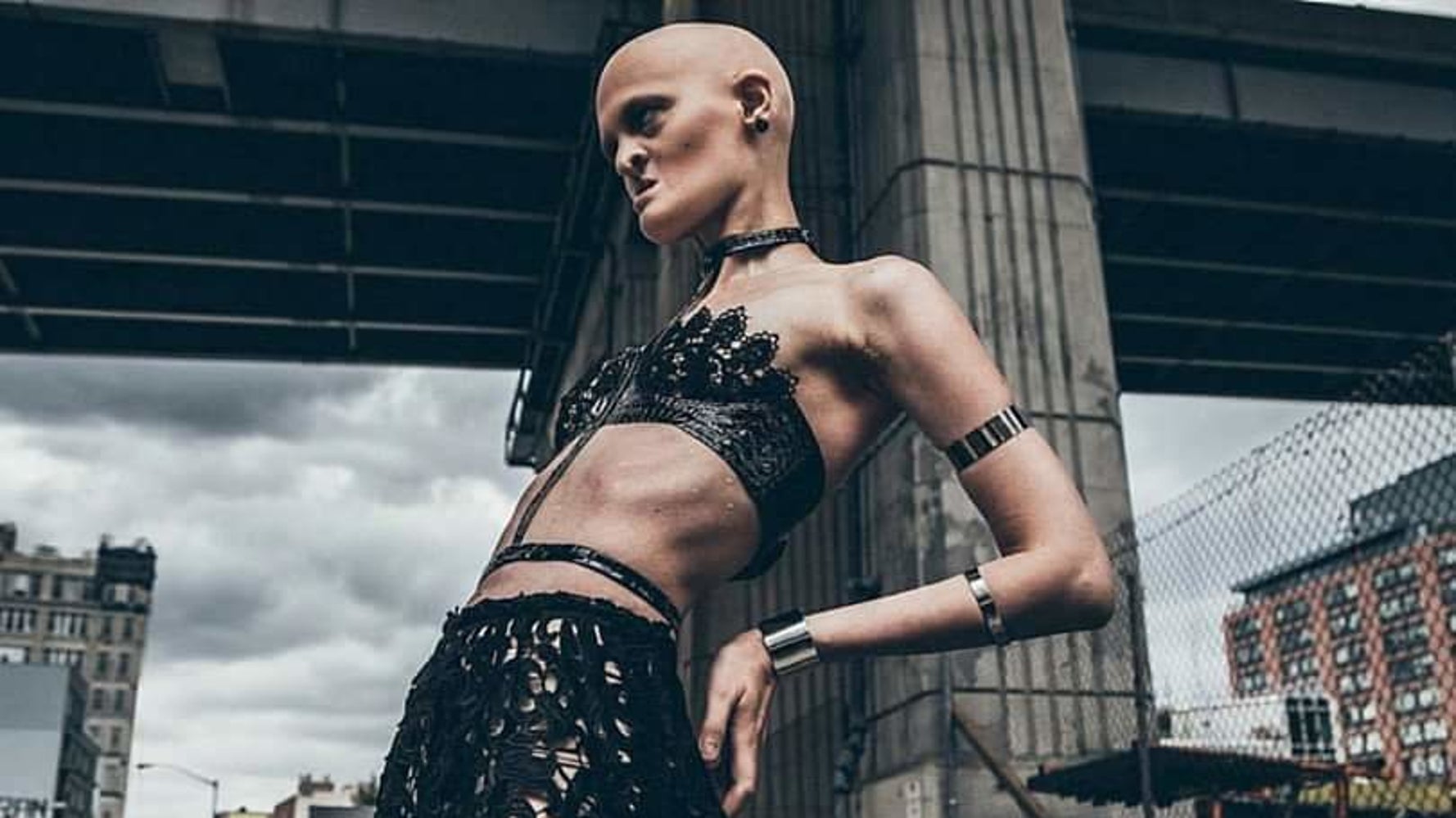 What makes Melanie Gaydos so unique? (Learn about her brave journey in the fashion industry now)